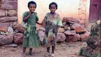 Pomóż głodującym w ogarniętej wojną domową Etiopii