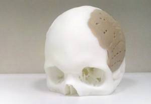 Drukowana czaszka