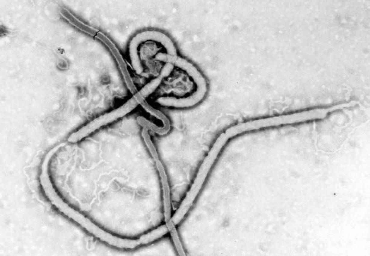Nawet 30 tysięcy zagrożonych wirusem Ebola