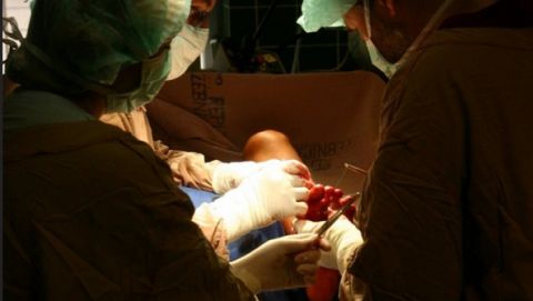 Pierwsze na świecie przeszczepienie dłoni dorosłemu pacjentowi