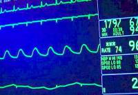 Pierwsze w Polsce wszczepienie podskórnego monitora rytmu serca
