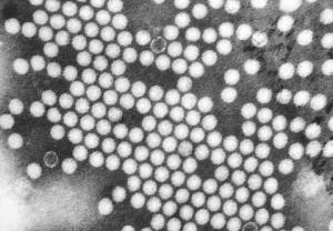 Fotomikrografia wirusa polio z transmisyjnego mikroskopu elektronowego 